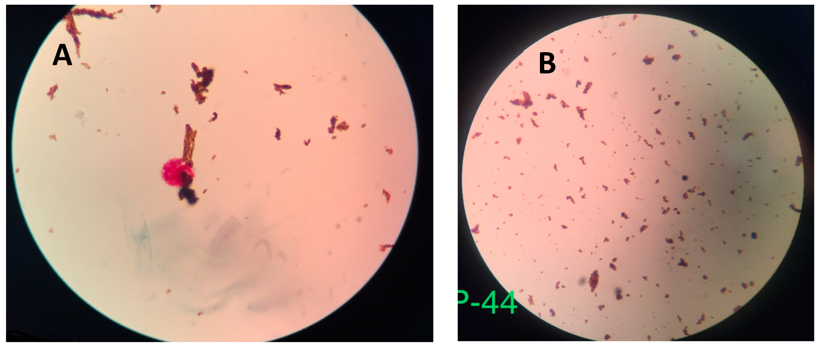 Biosensors 09 00001 g005