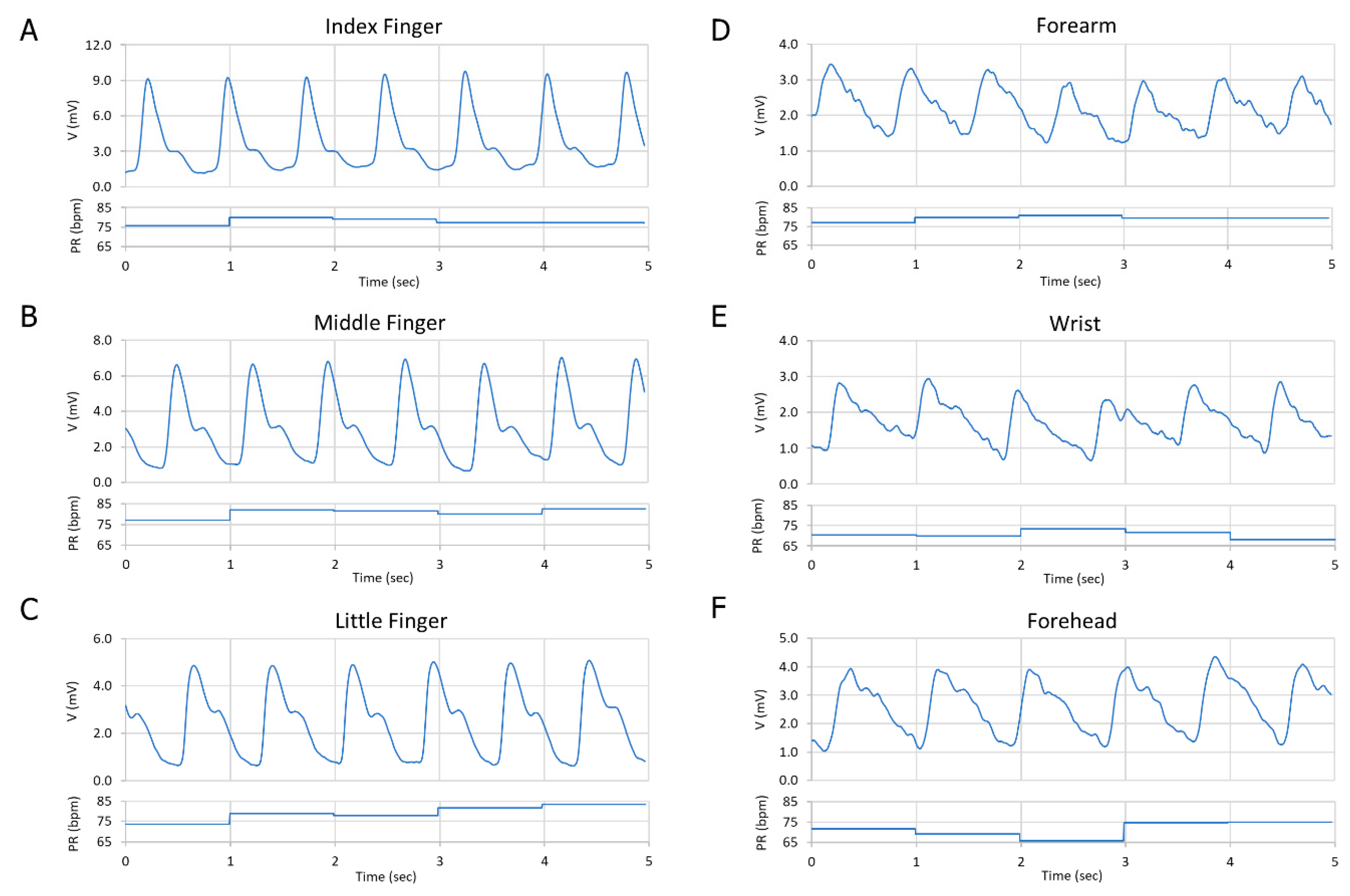 Biosensors 09 00048 g008