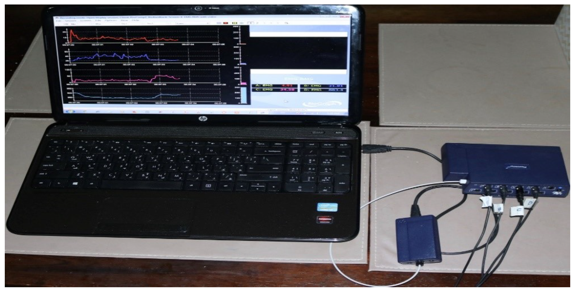 Biosensors 09 00114 g002