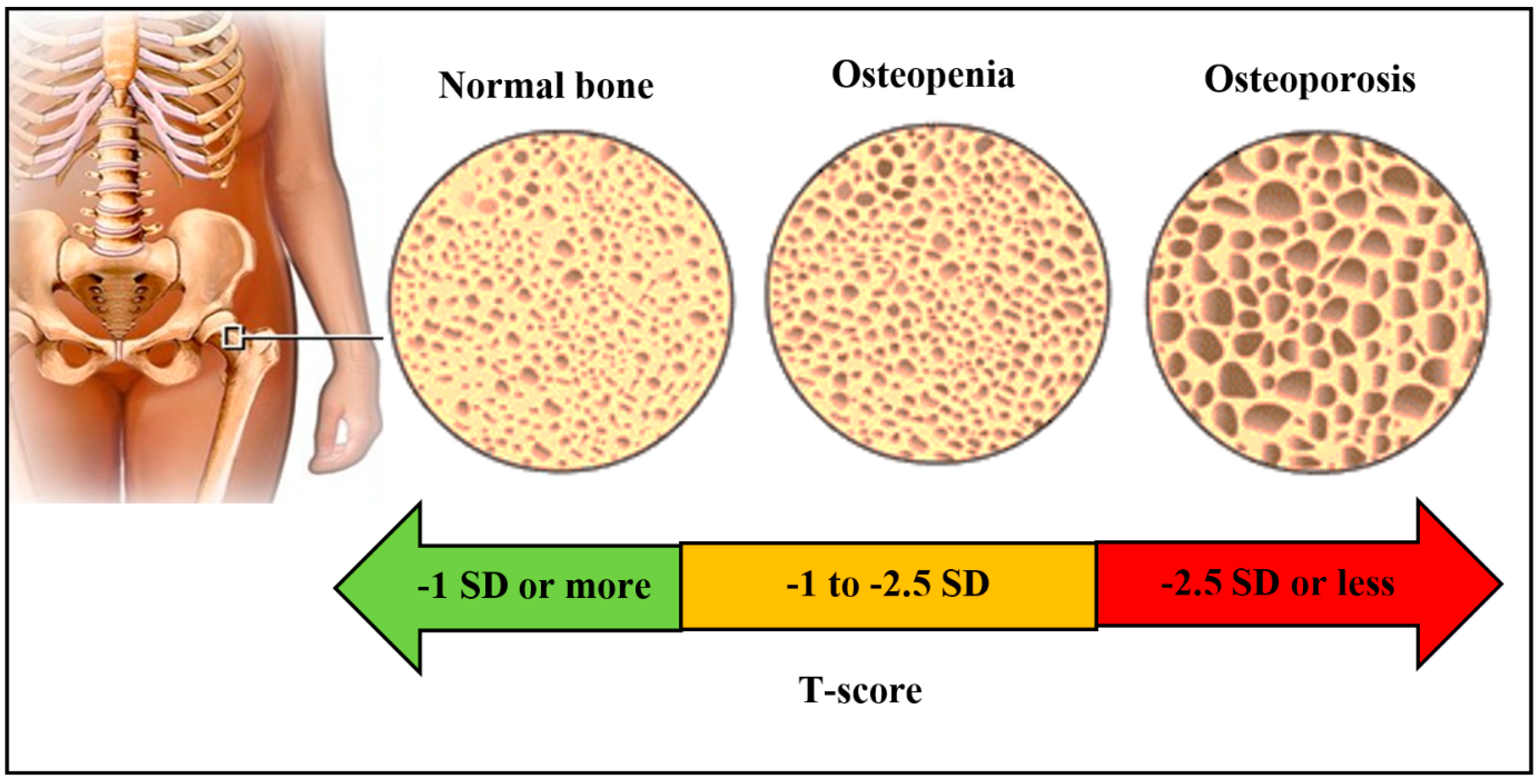 Biosensors 10 00042 g003