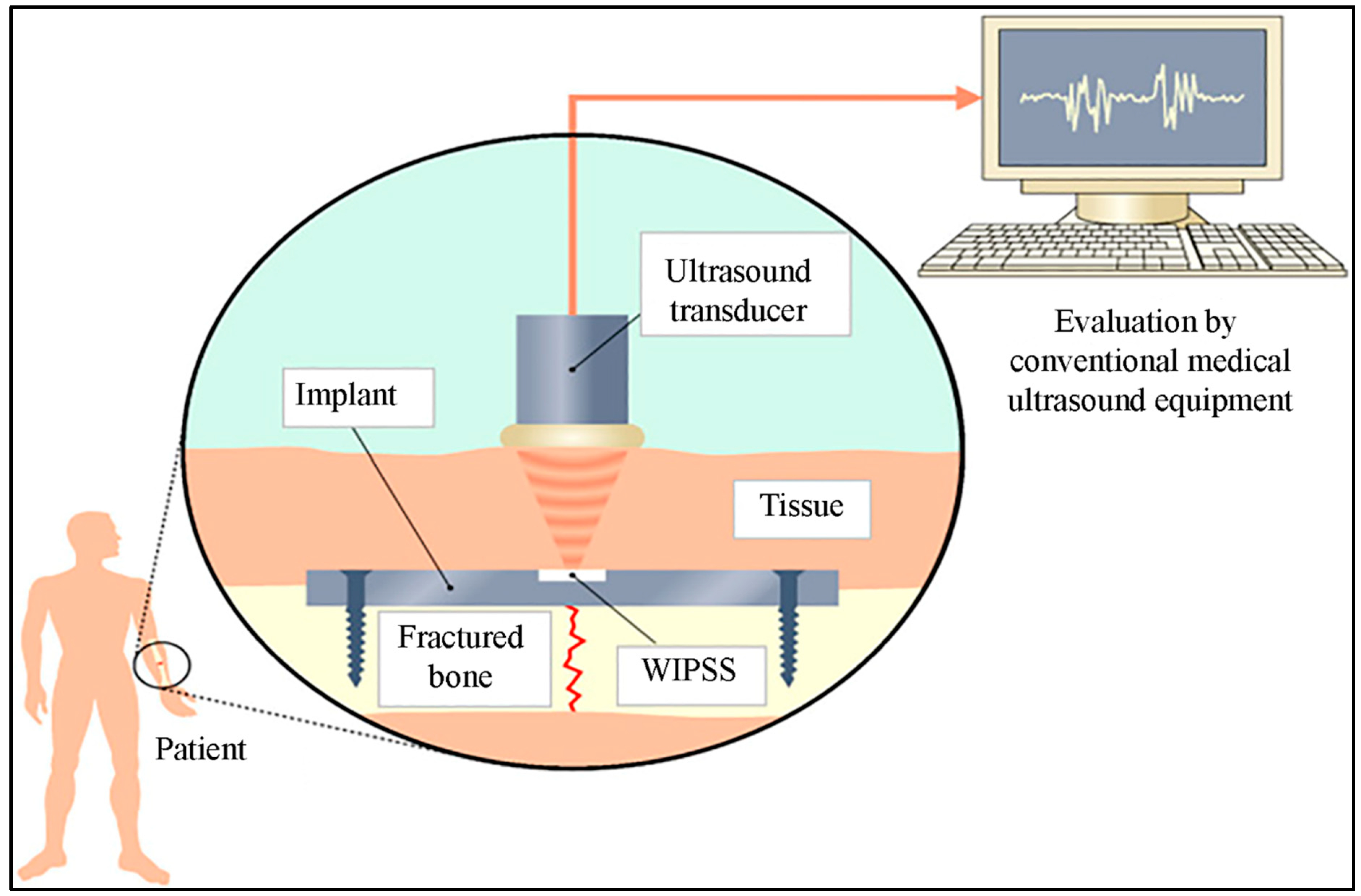 Biosensors 10 00042 g004