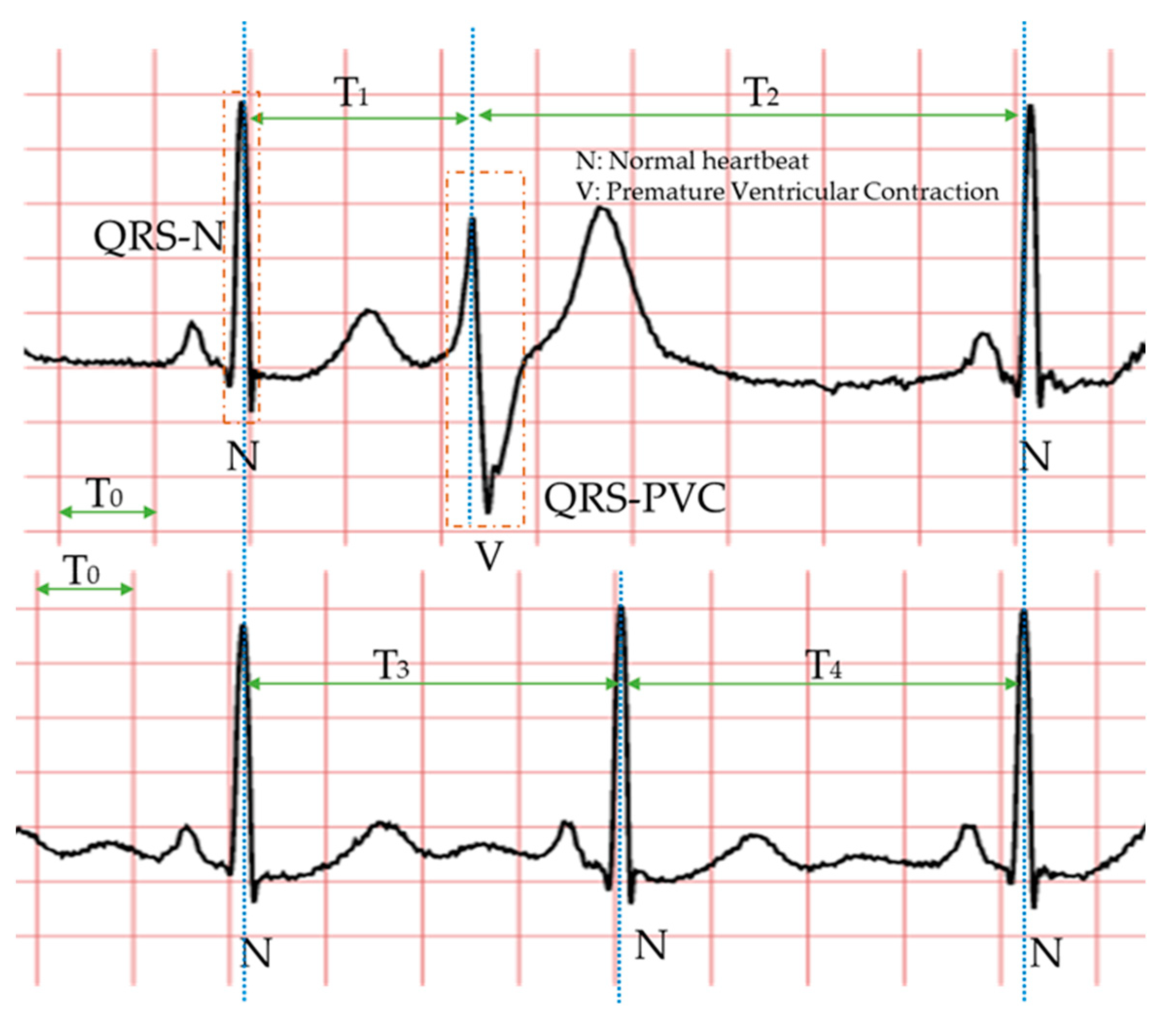 Biosensors 11 00069 g002