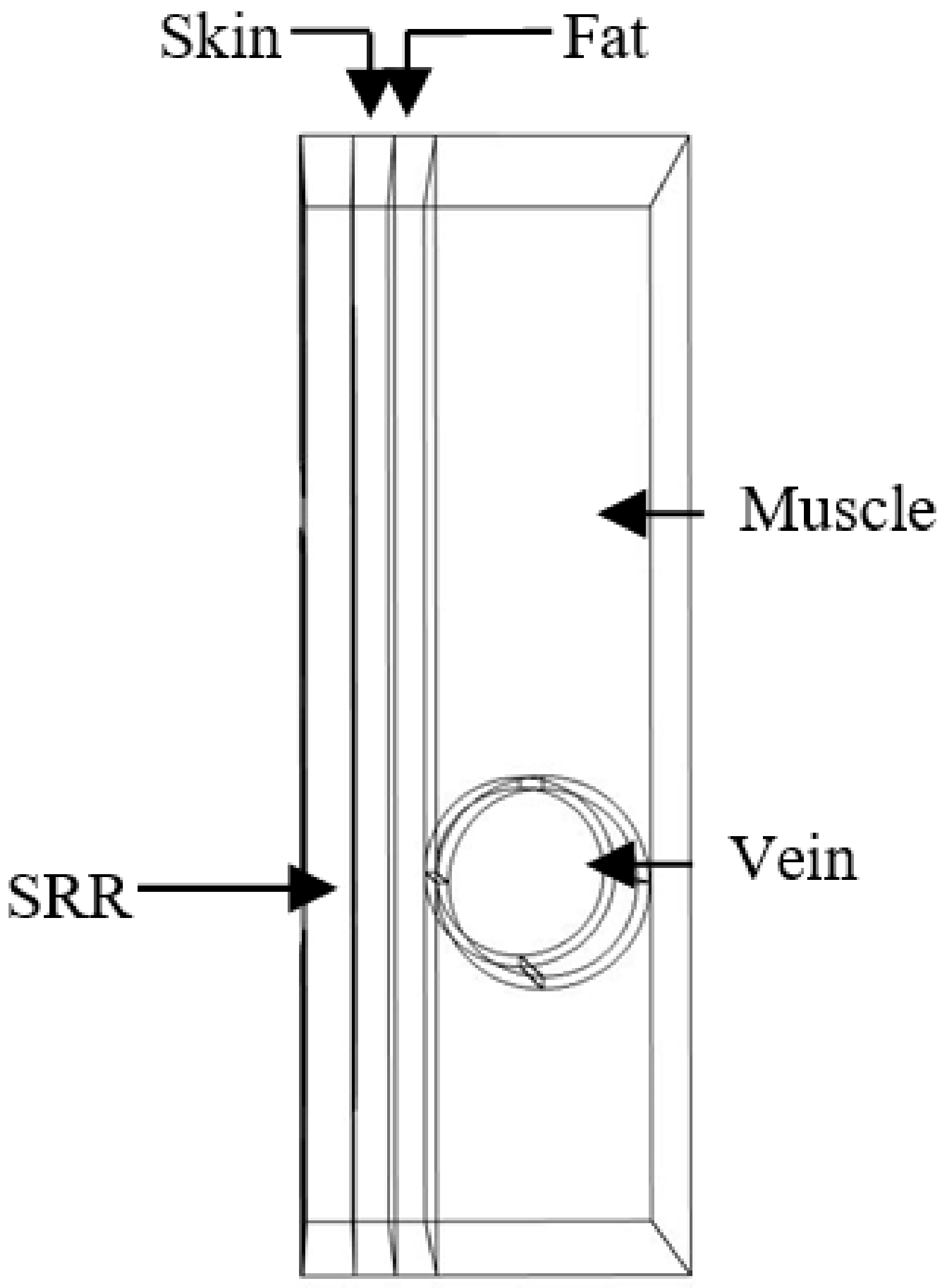 Biosensors 11 00083 g004