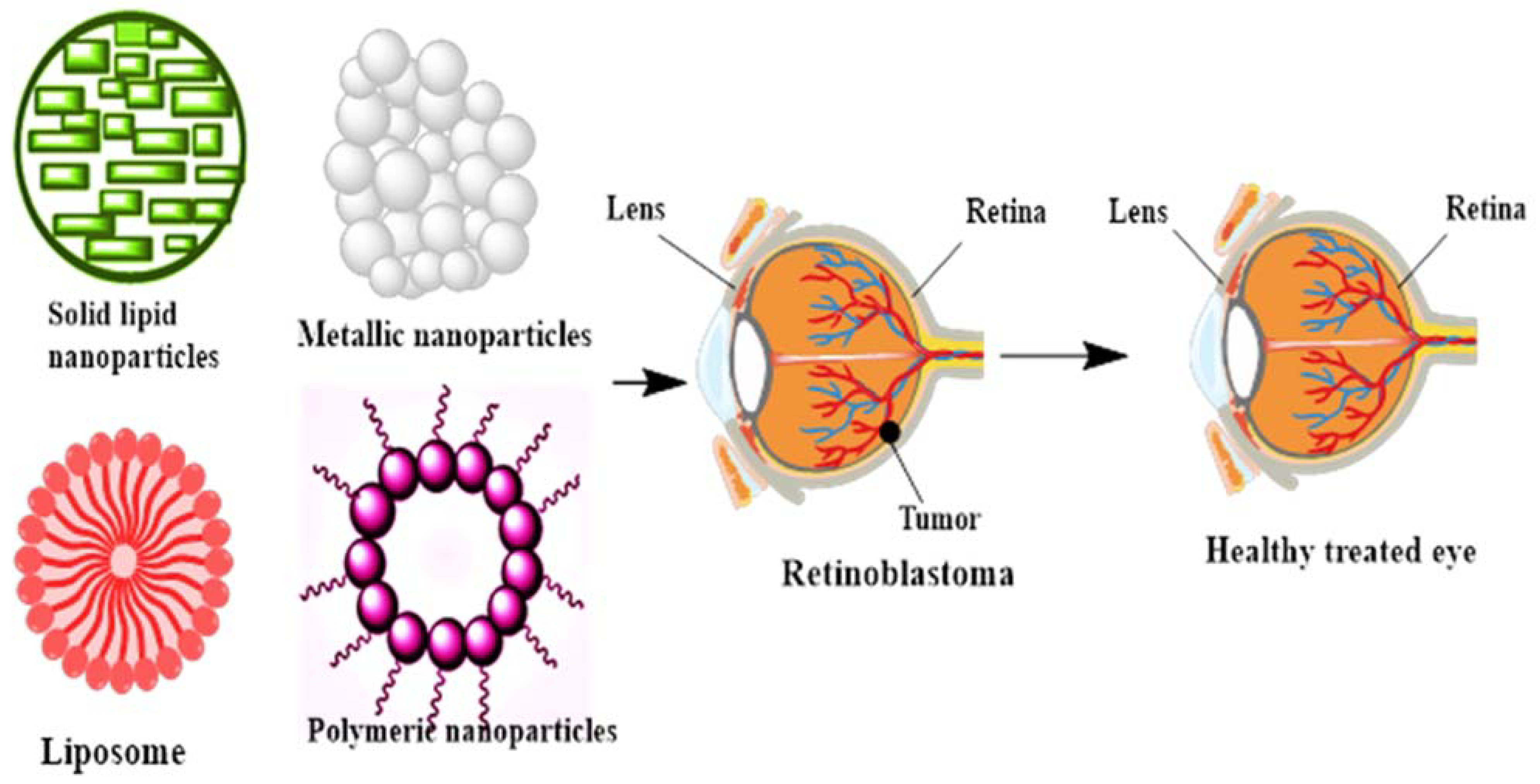 Biosensors 11 00097 g001