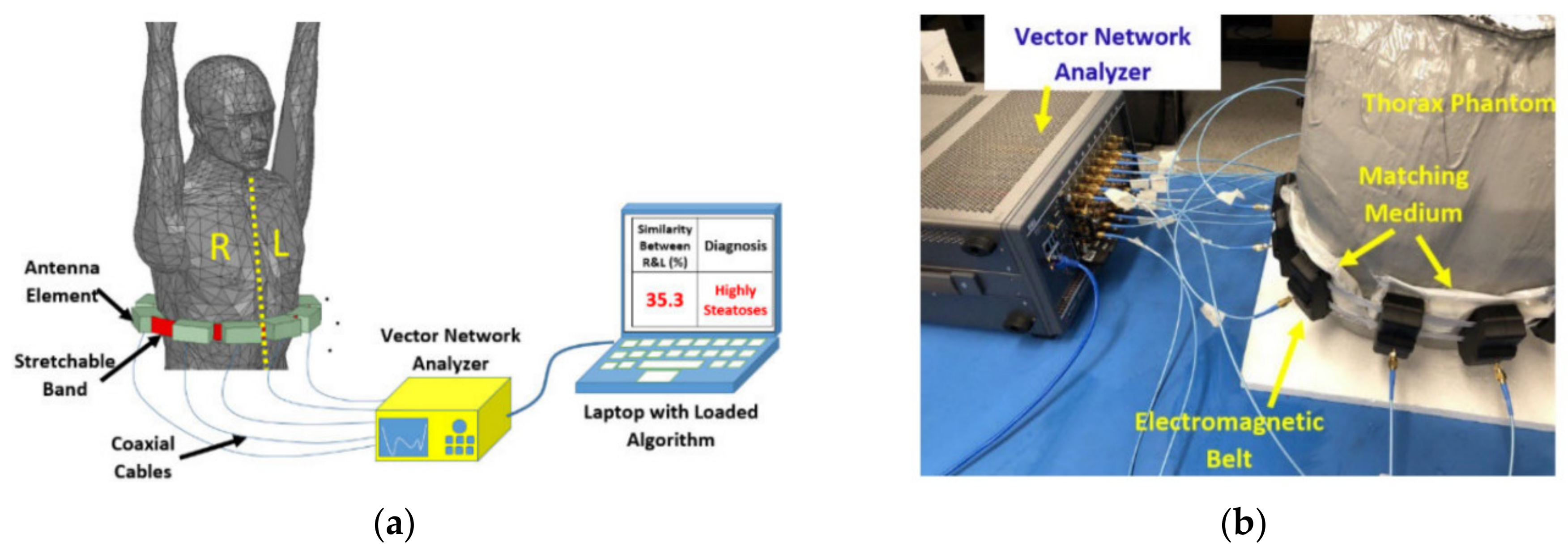 Biosensors 11 00135 g006