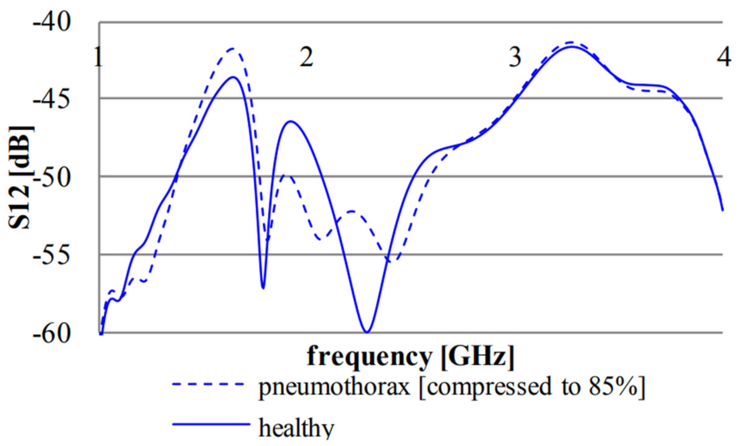 Biosensors 11 00135 g018