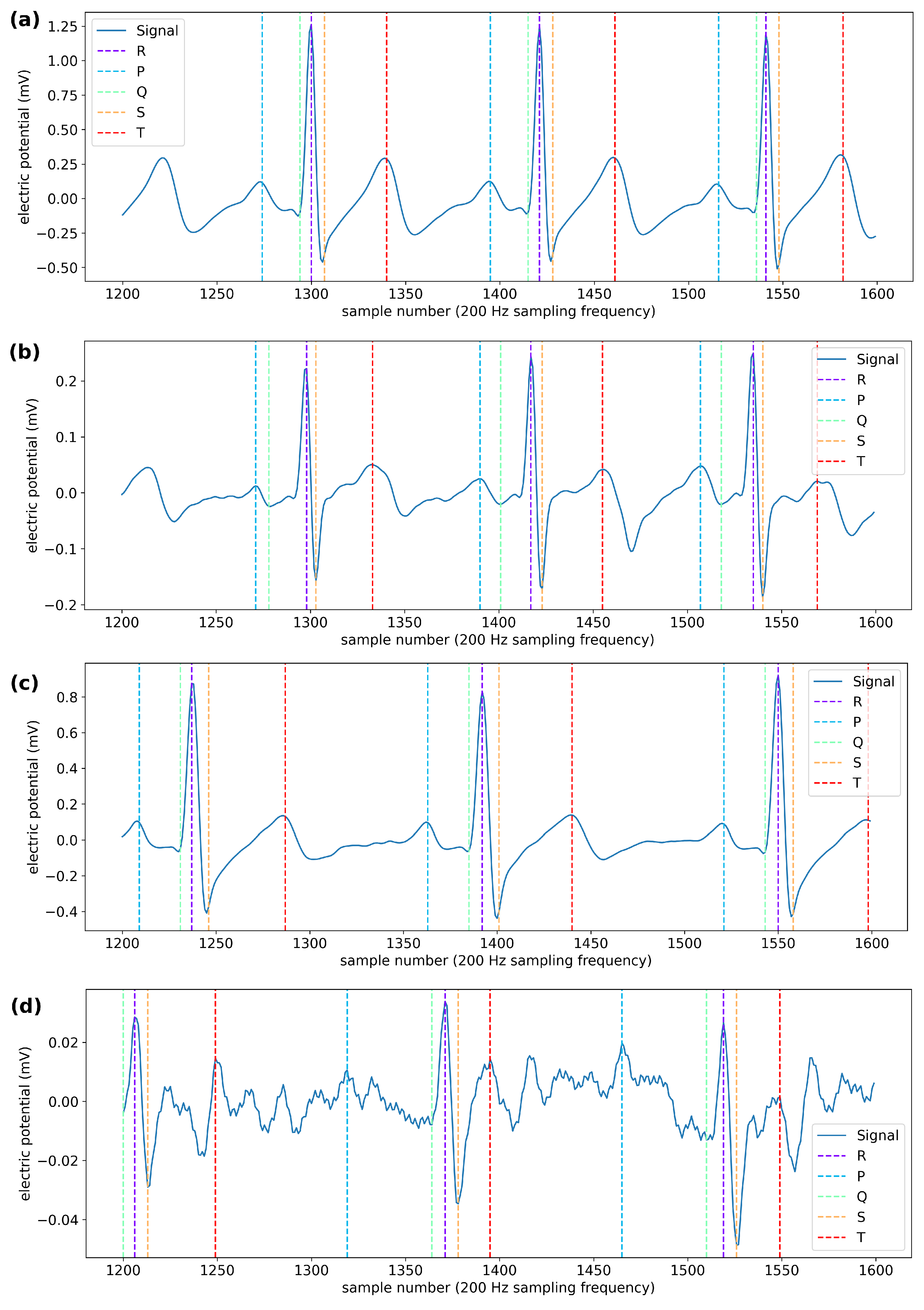 Biosensors 11 00331 g006