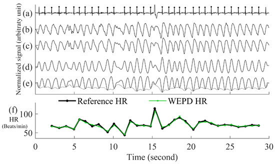Biosensors 12 00082 g003