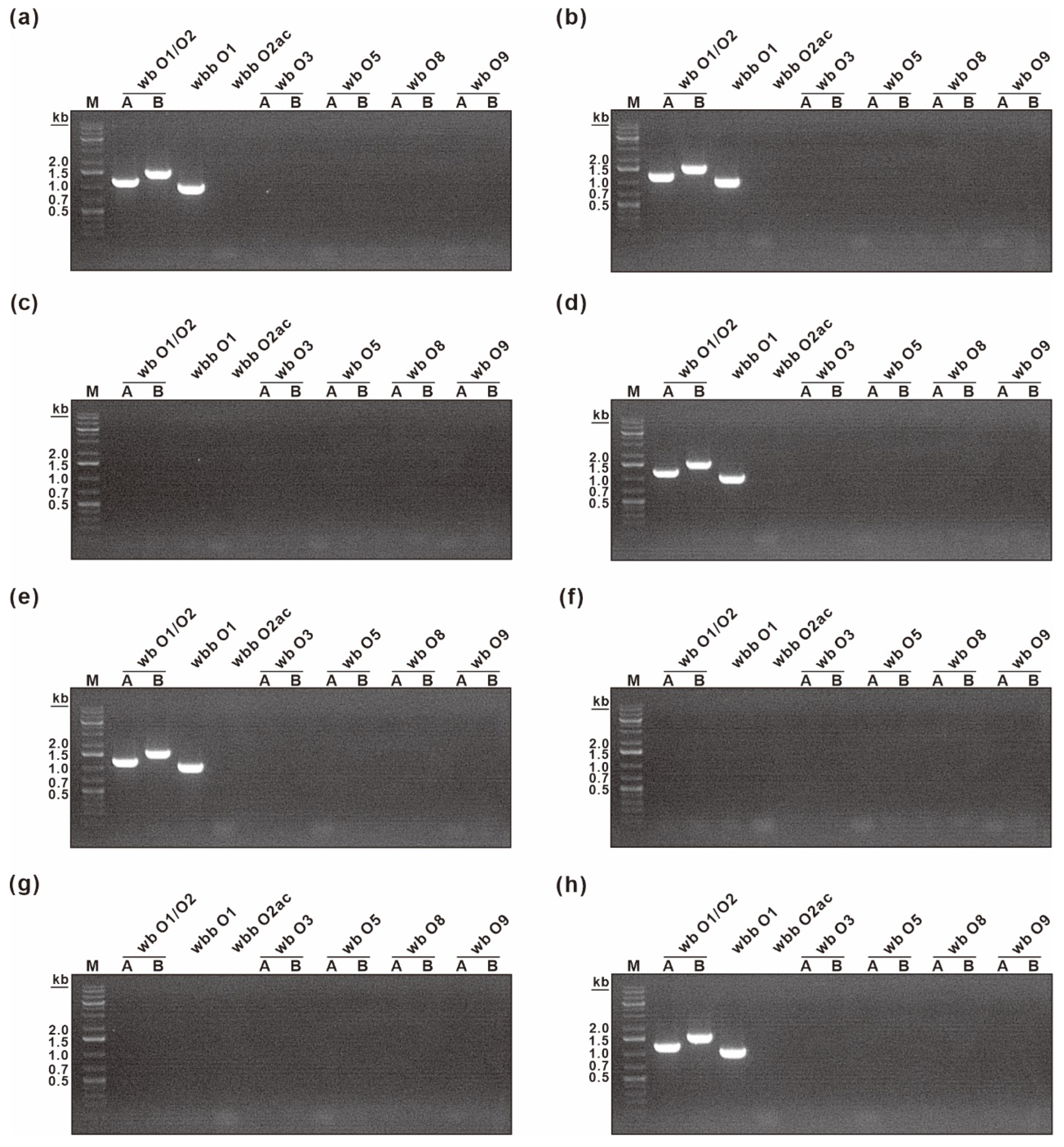 Biosensors 12 00153 g006