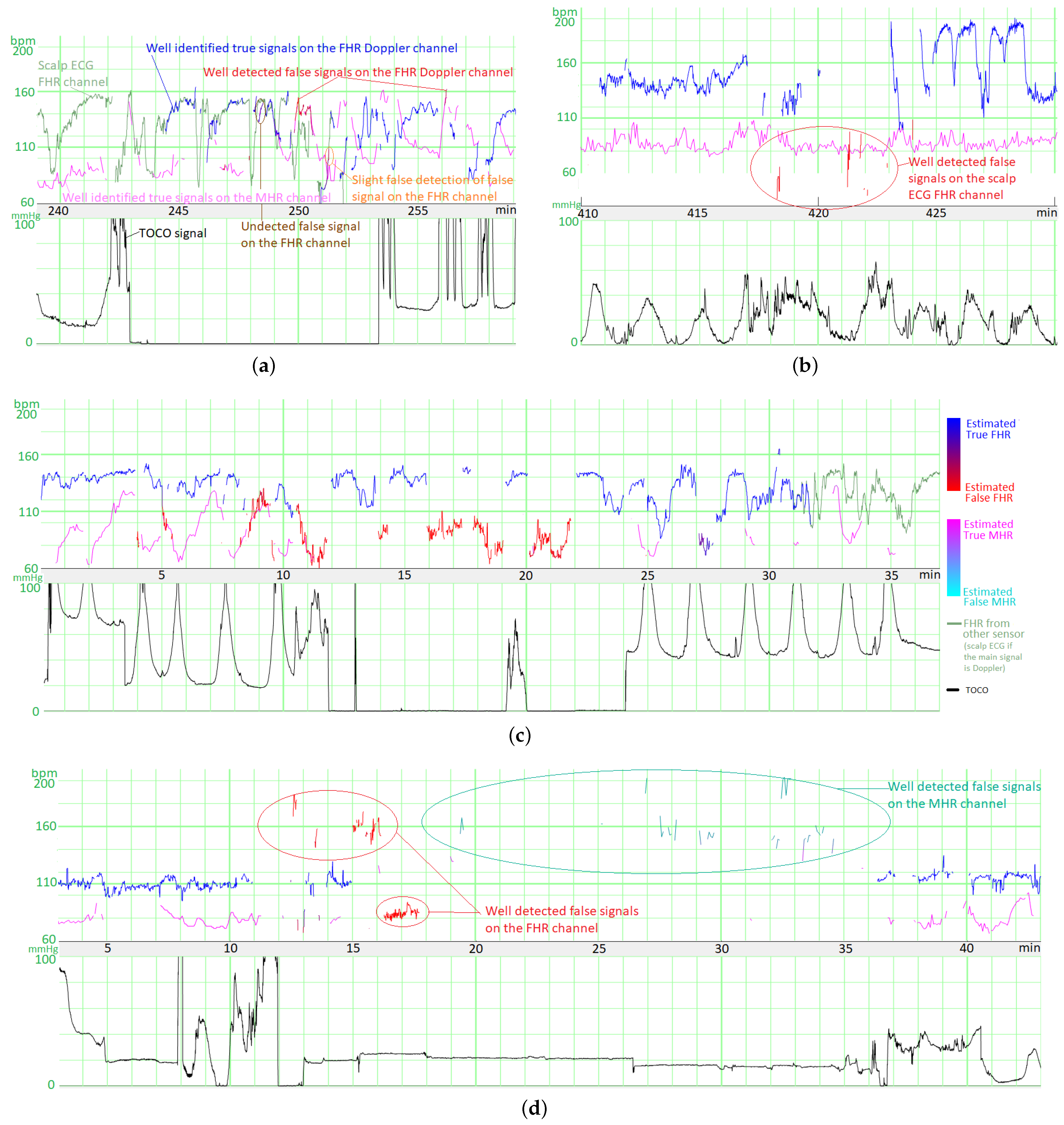 Biosensors 12 00691 g006