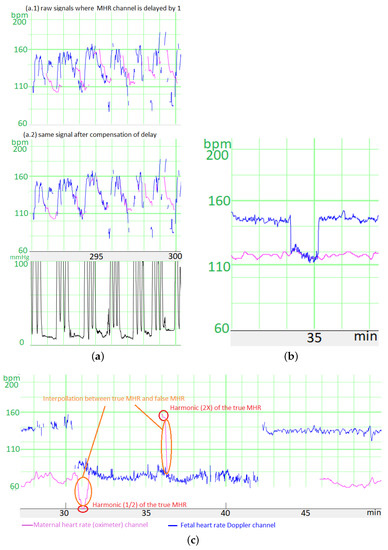 Biosensors 12 00691 g0a1 550