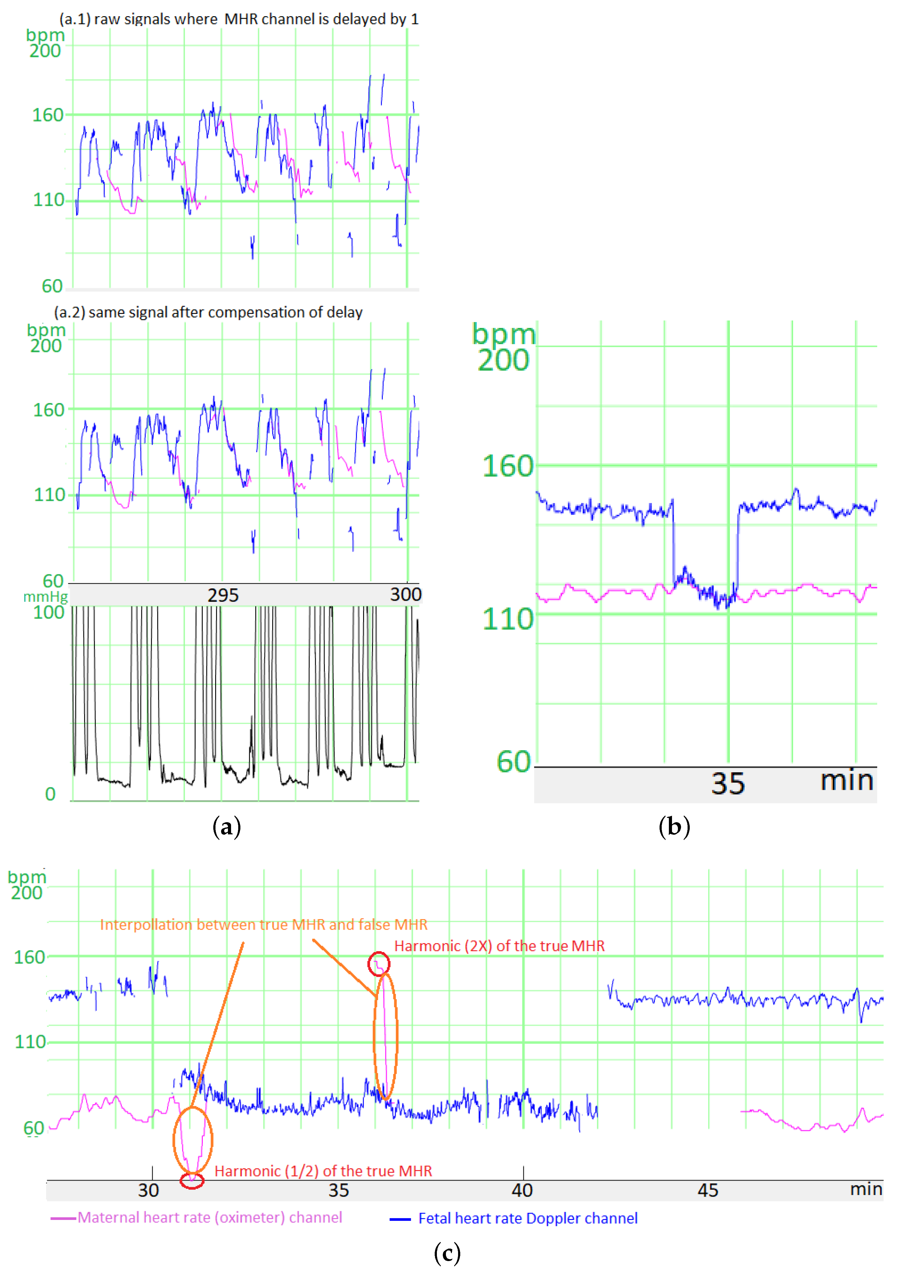 Biosensors 12 00691 g0a1