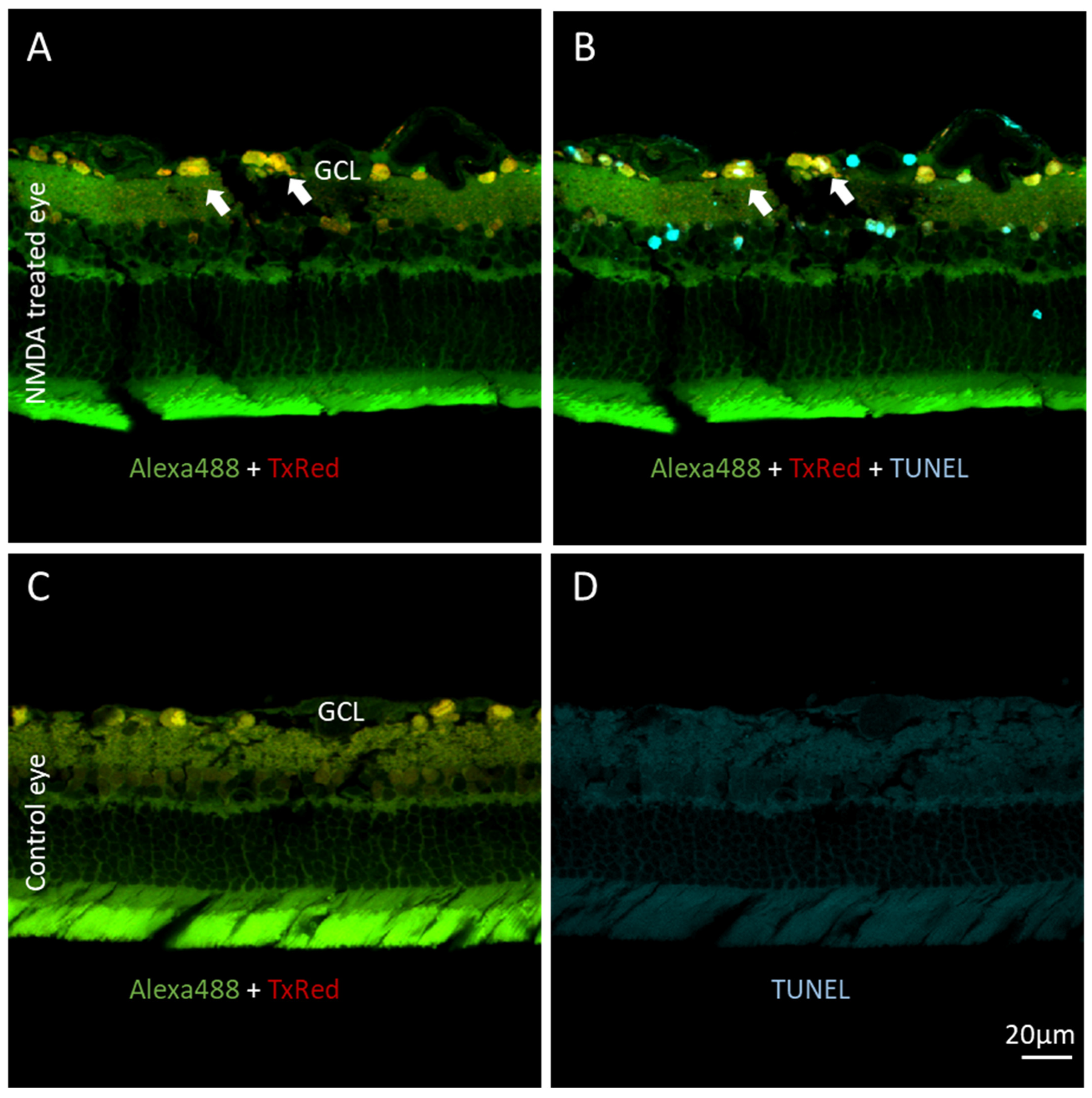 Biosensors 12 00693 g004 Biosensors 12 00693 g004
