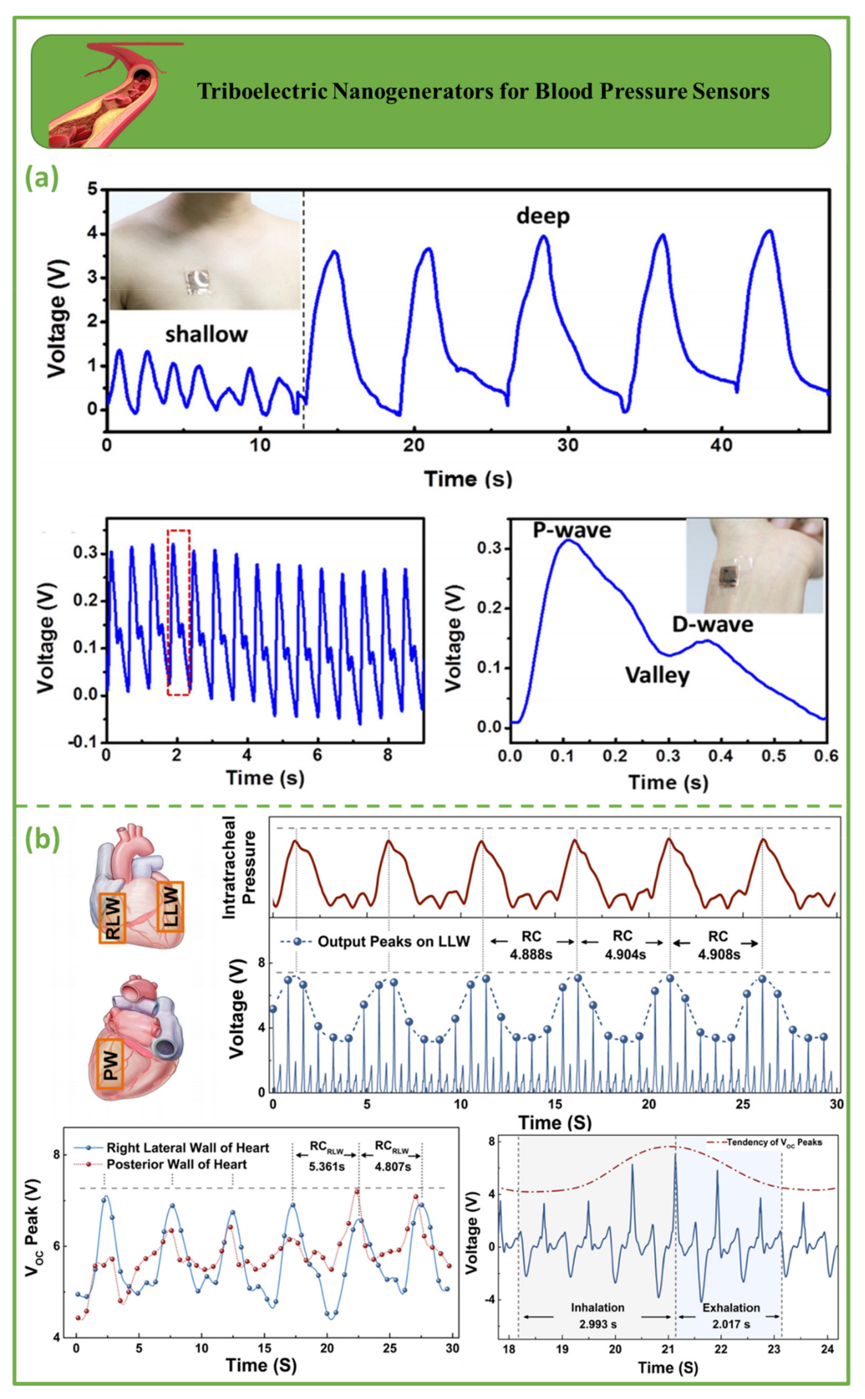 Biosensors 12 00697 g006