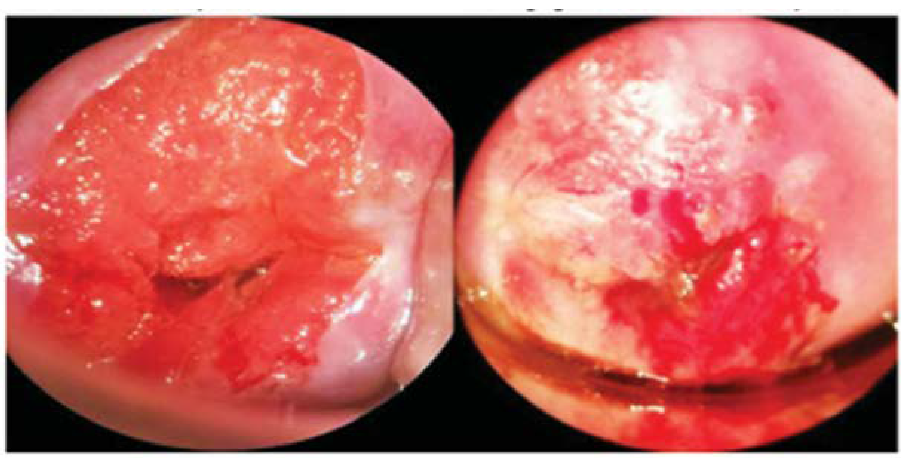 Biosensors 12 00786 g011