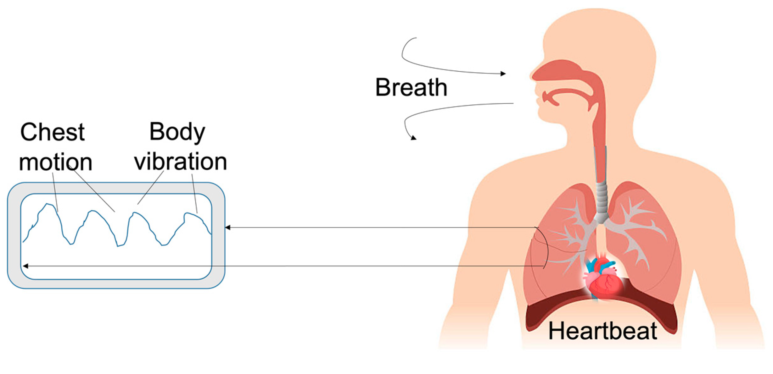 Biosensors 12 00835 g009