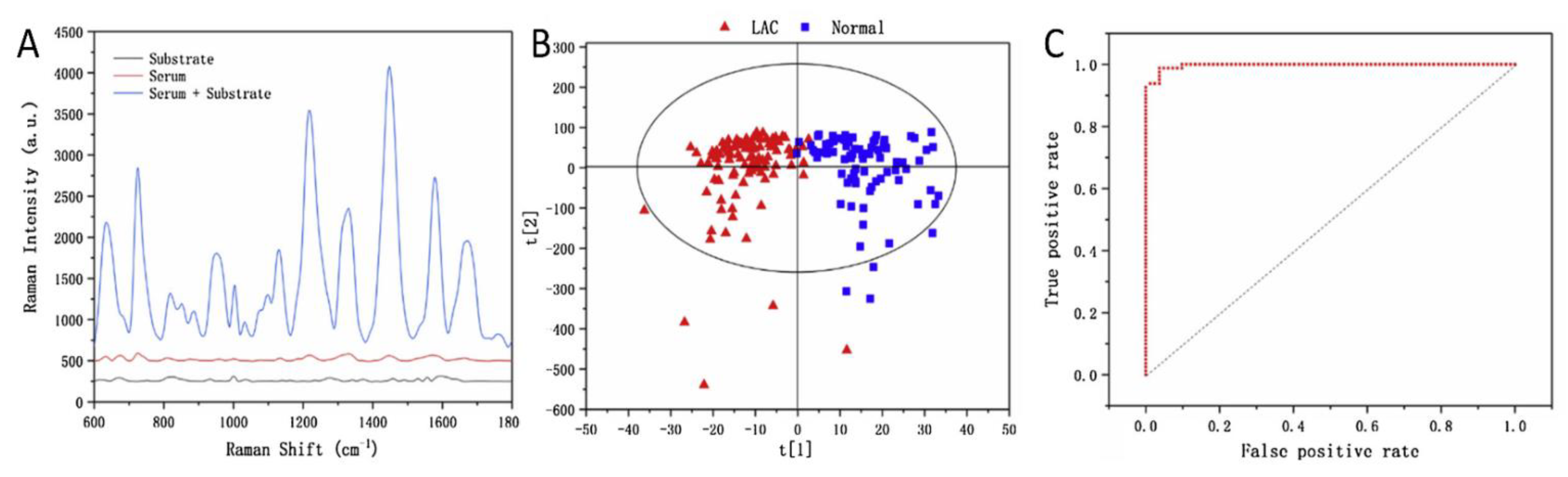 Biosensors 12 00967 g006