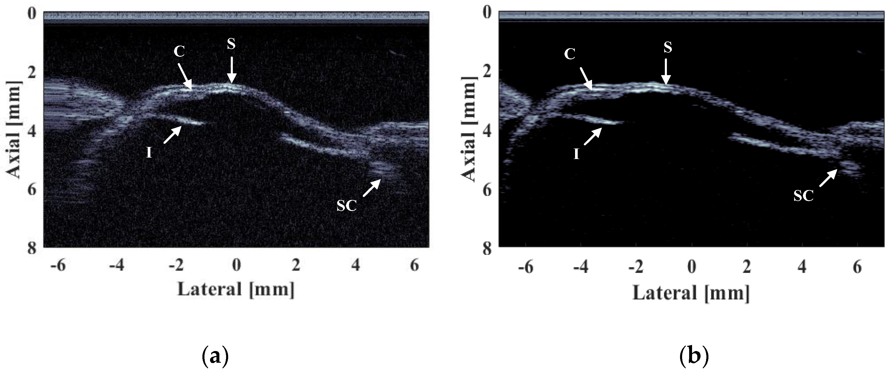 Biosensors 13 00032 g014 Biosensors 13 00032 g014