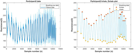 Biosensors 13 00034 g0a17