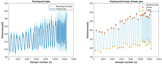 Biosensors 13 00034 g0a18