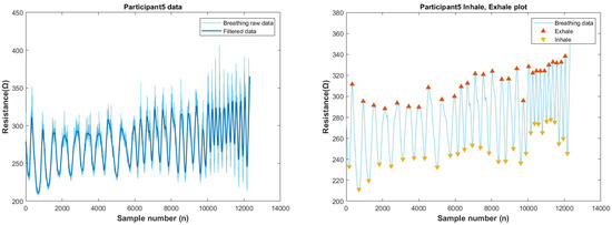 Biosensors 13 00034 g0a20