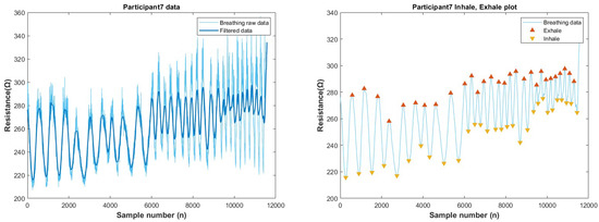 Biosensors 13 00034 g0a22