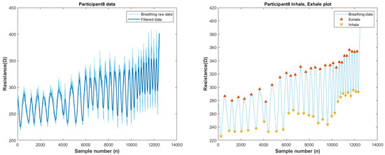 Biosensors 13 00034 g0a23