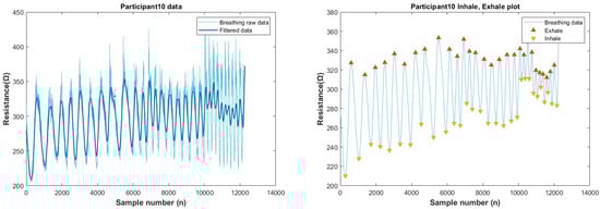 Biosensors 13 00034 g0a25