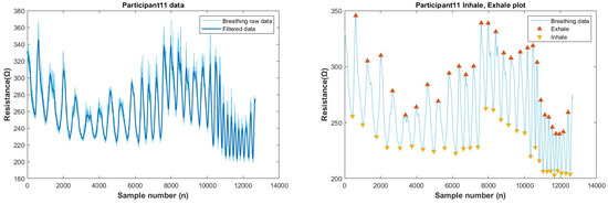 Biosensors 13 00034 g0a26