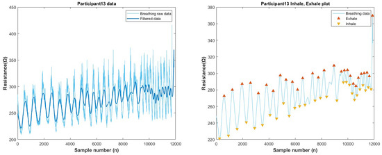 Biosensors 13 00034 g0a28