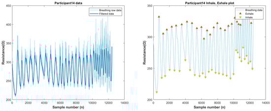 Biosensors 13 00034 g0a29