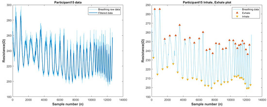 Biosensors 13 00034 g0a30