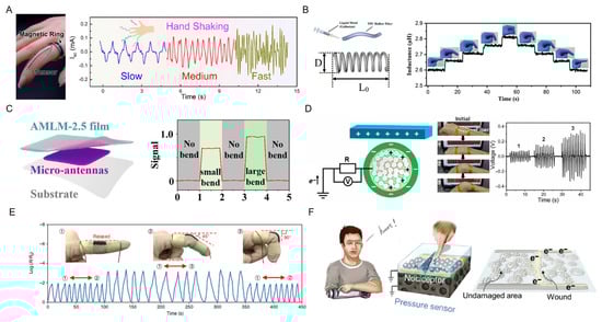 Biosensors 13 00084 g012