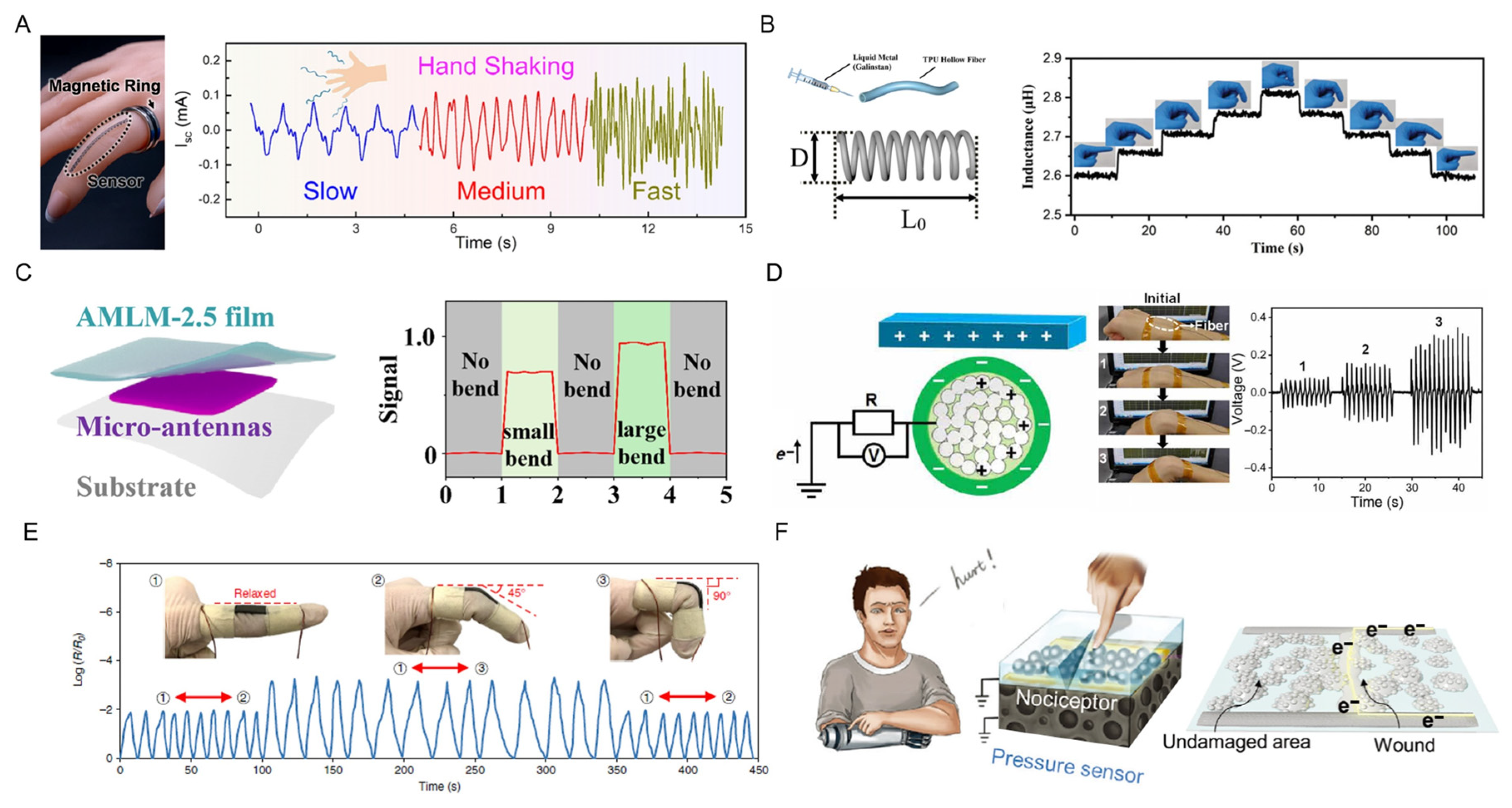 Biosensors 13 00084 g012