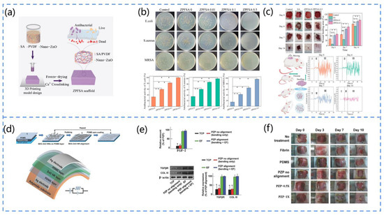 Biosensors 13 00113 g013