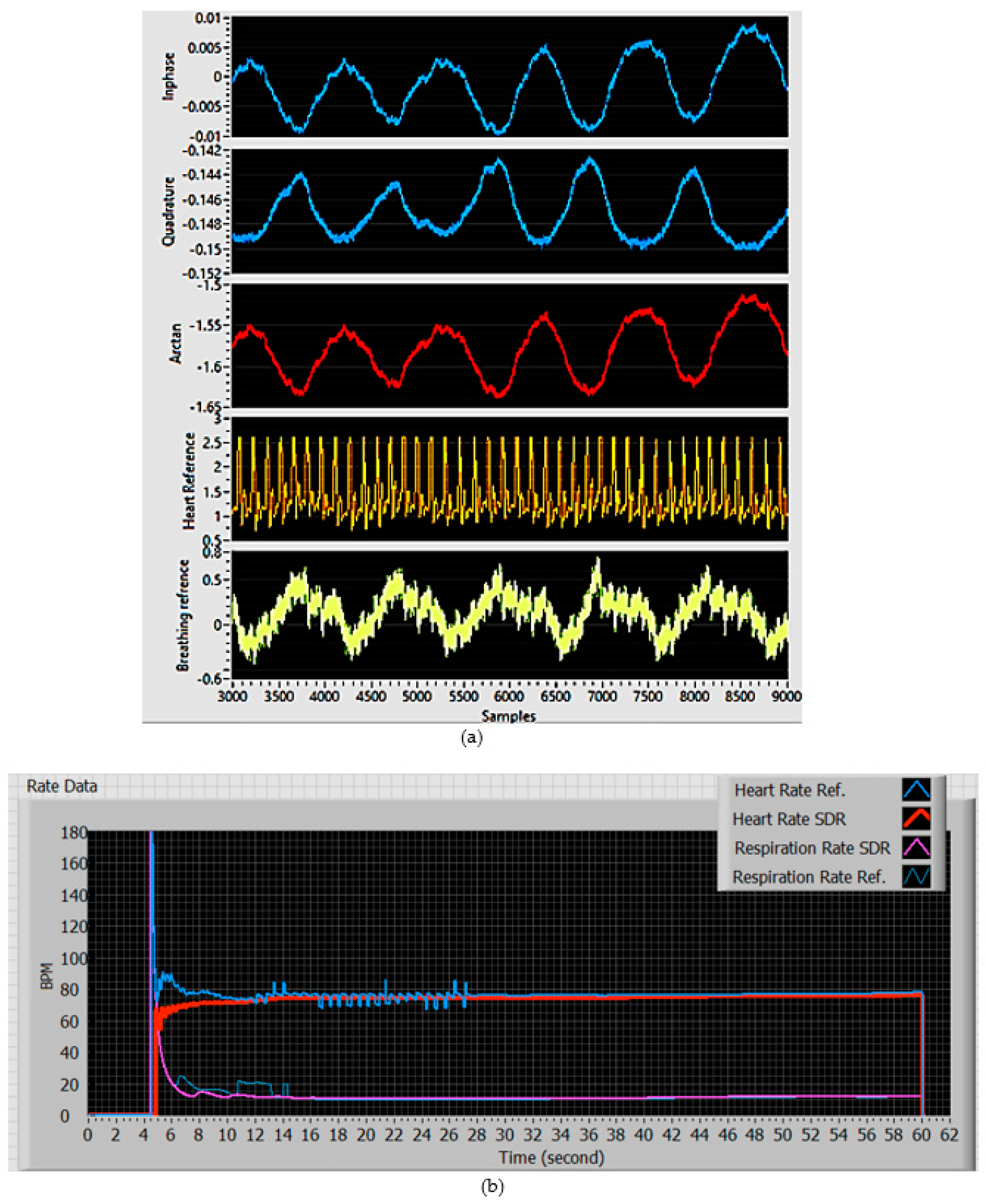 Biosensors 13 00191 g003