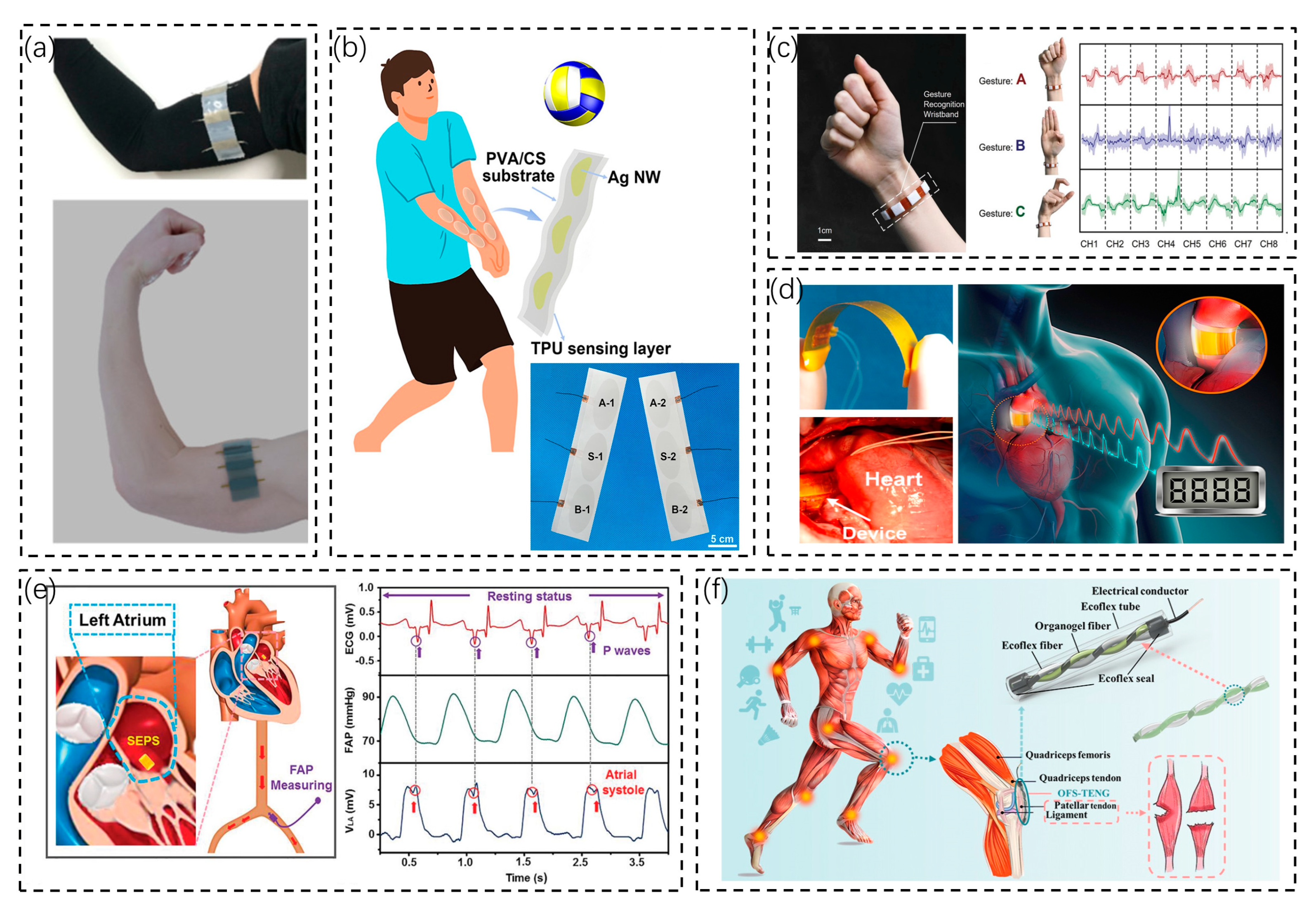 Biosensors 13 00236 g002