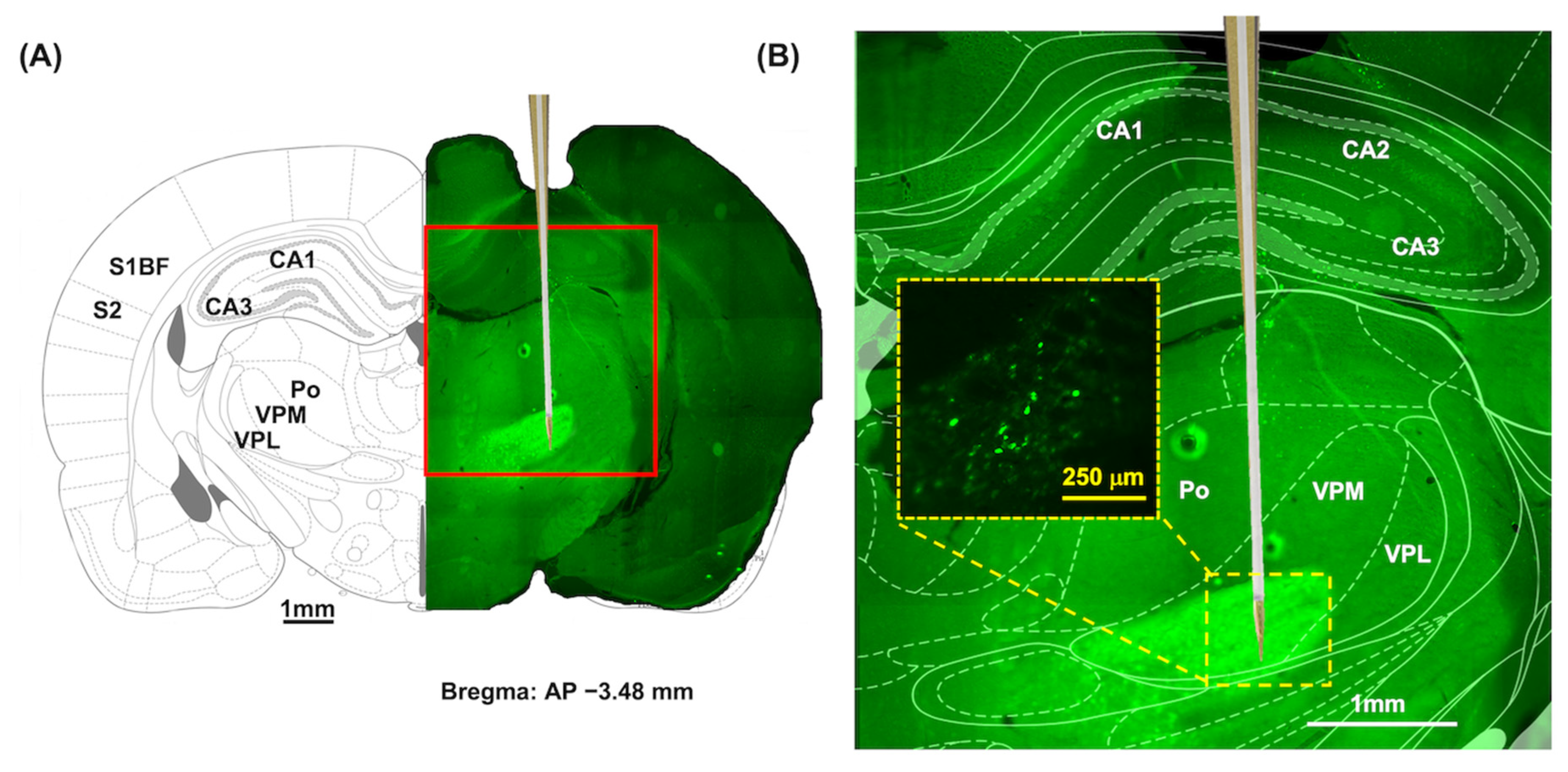Biosensors 13 00265 g006