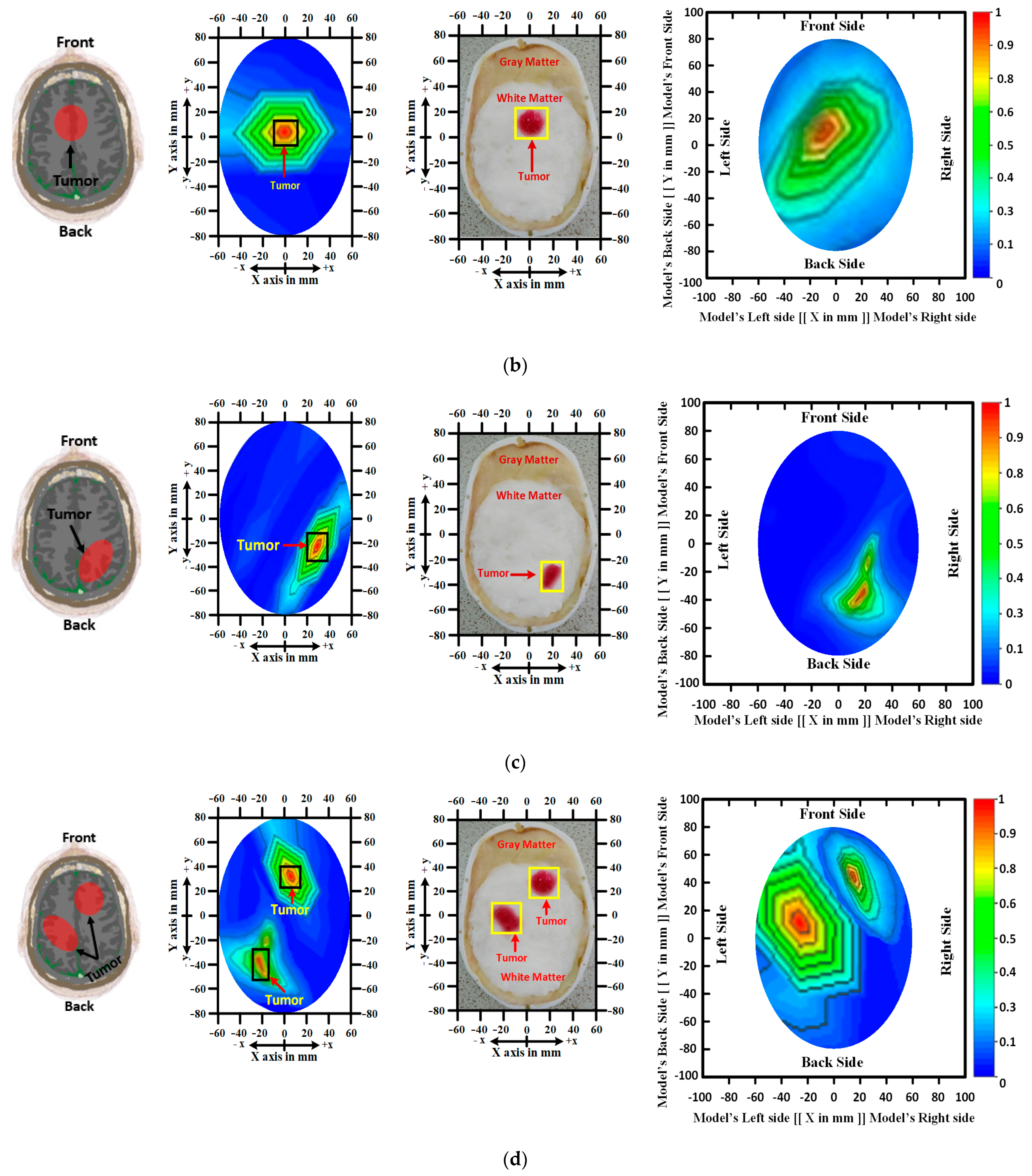 Biosensors 13 00302 g007b