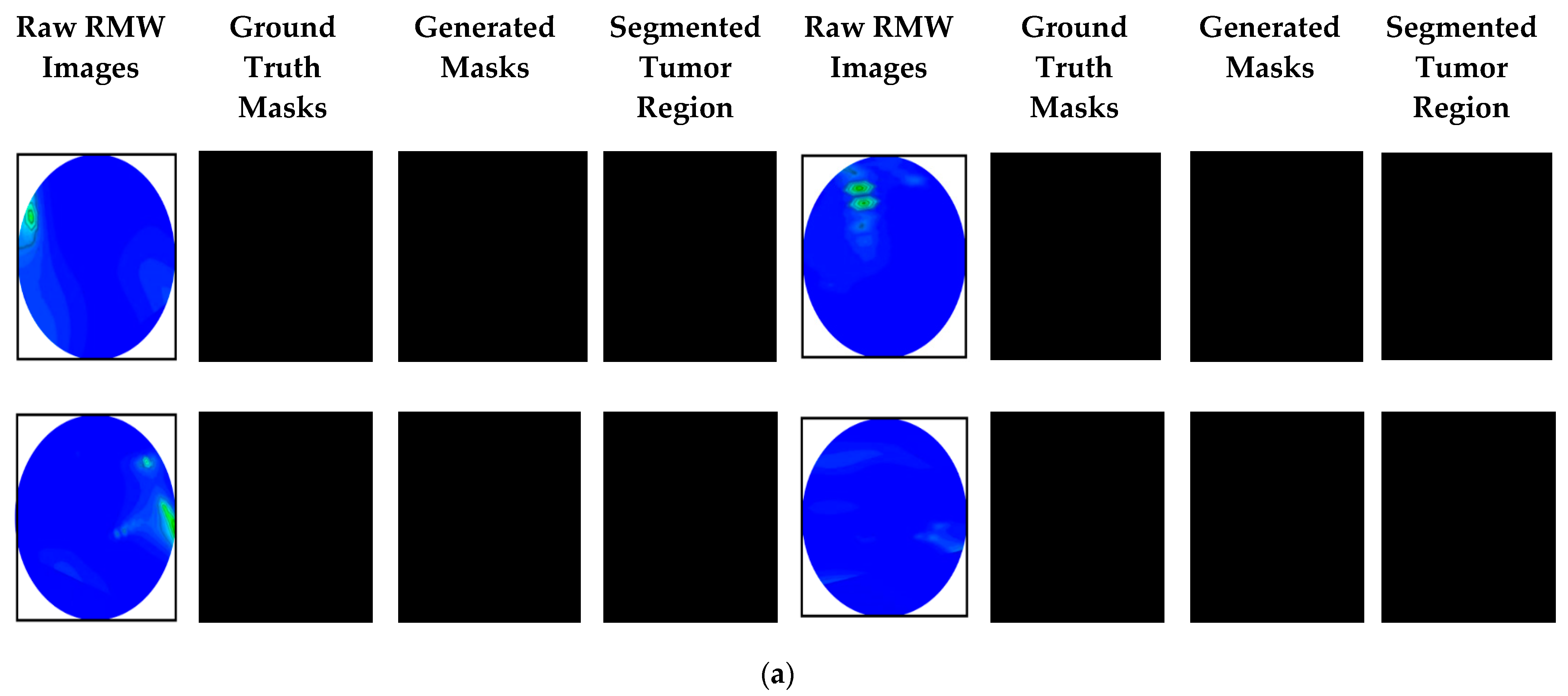 Biosensors 13 00302 g014a