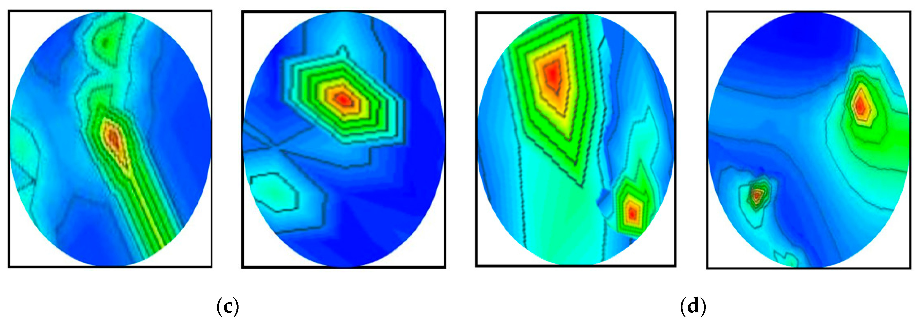 Biosensors 13 00302 g016b