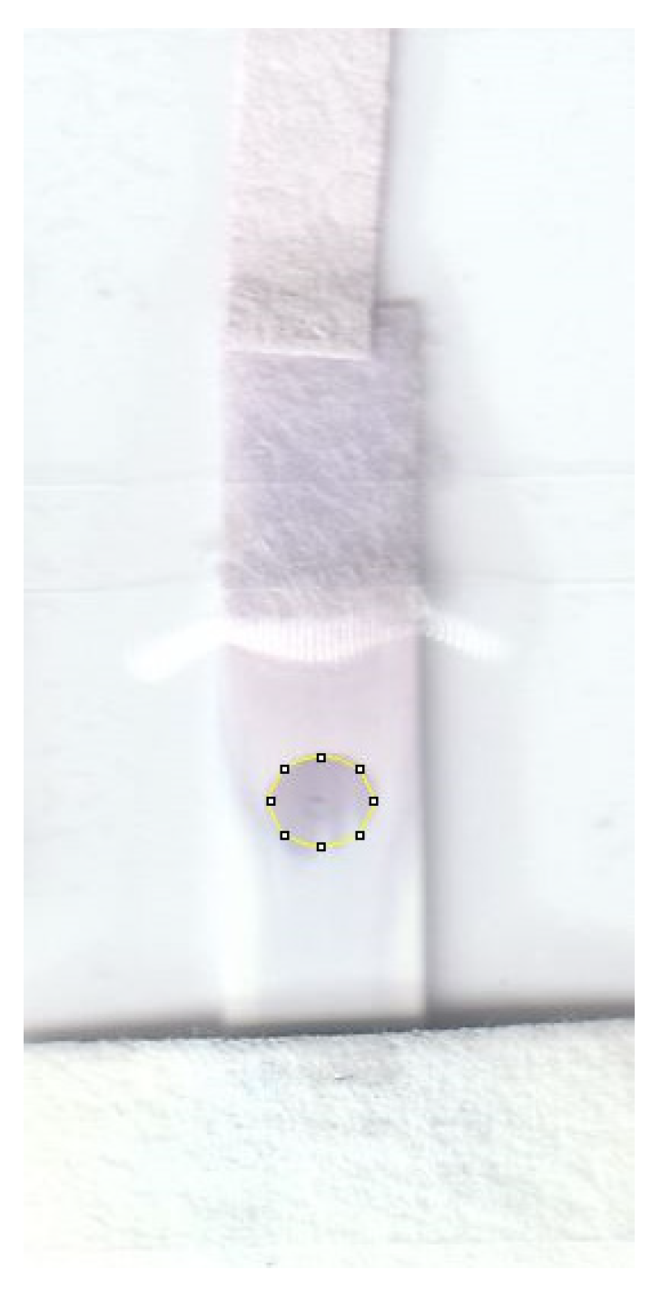 Biosensors 13 00310 g006