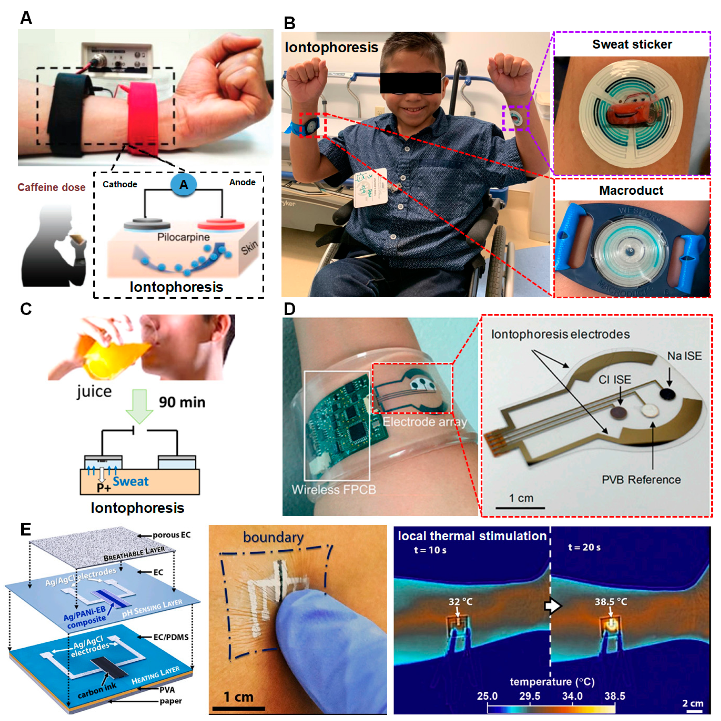 Biosensors 13 00313 g003