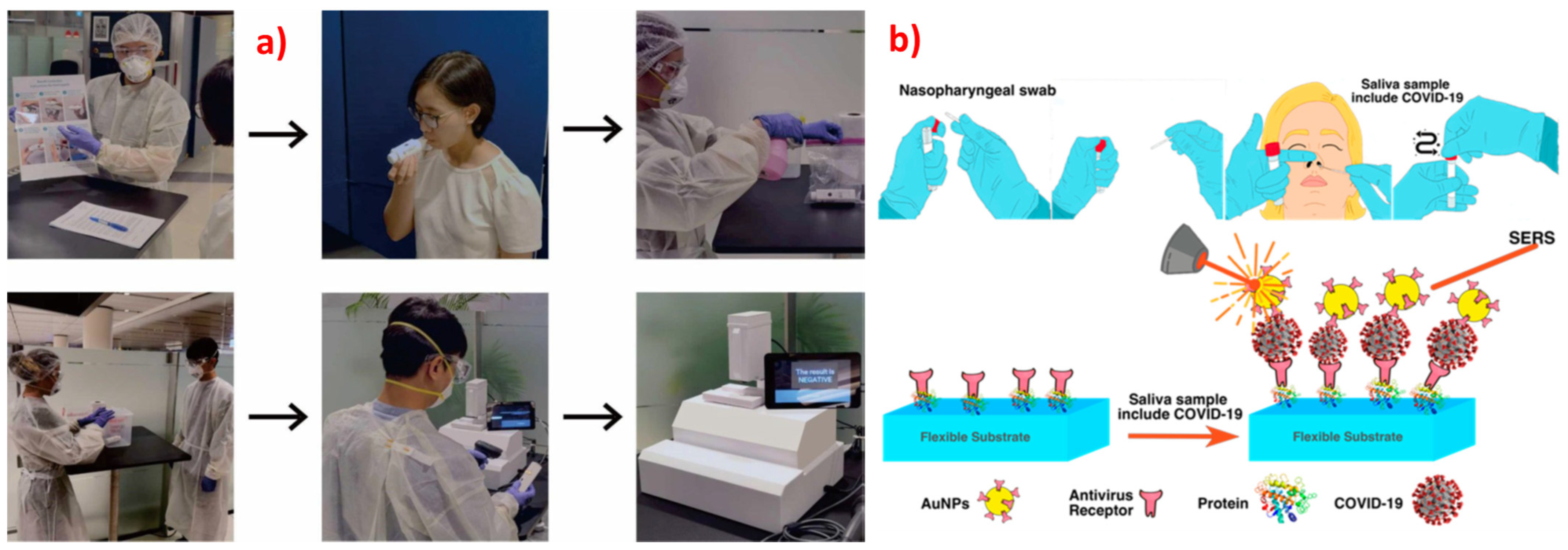Biosensors 13 00328 g005