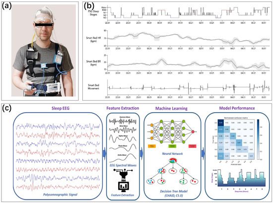 Biosensors 13 00395 g002