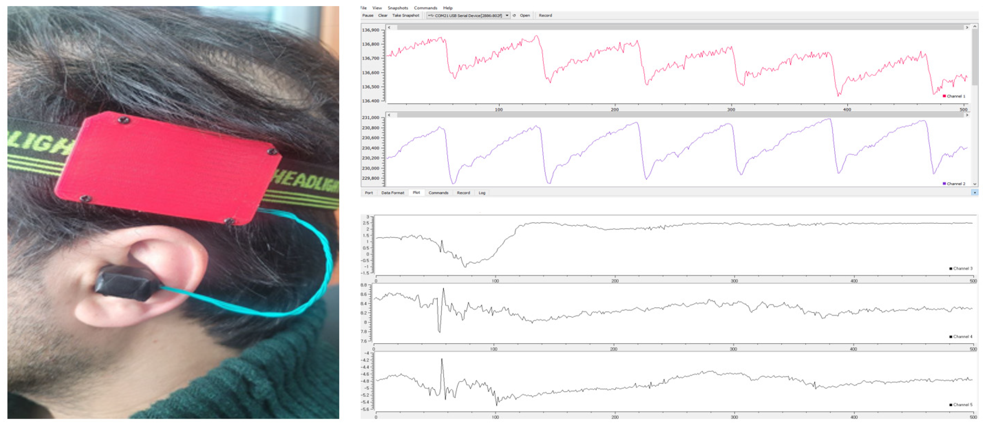 Biosensors 13 00397 g003
