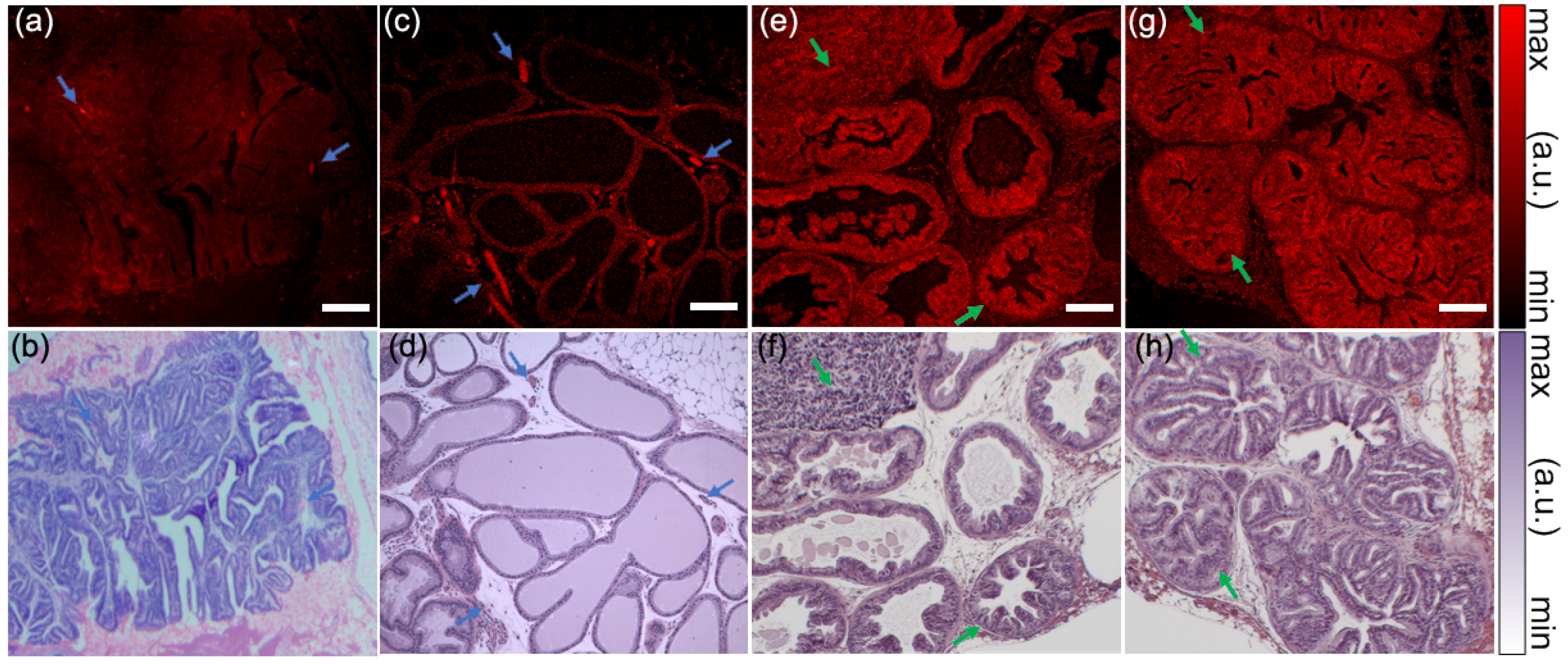 Biosensors 13 00403 g004