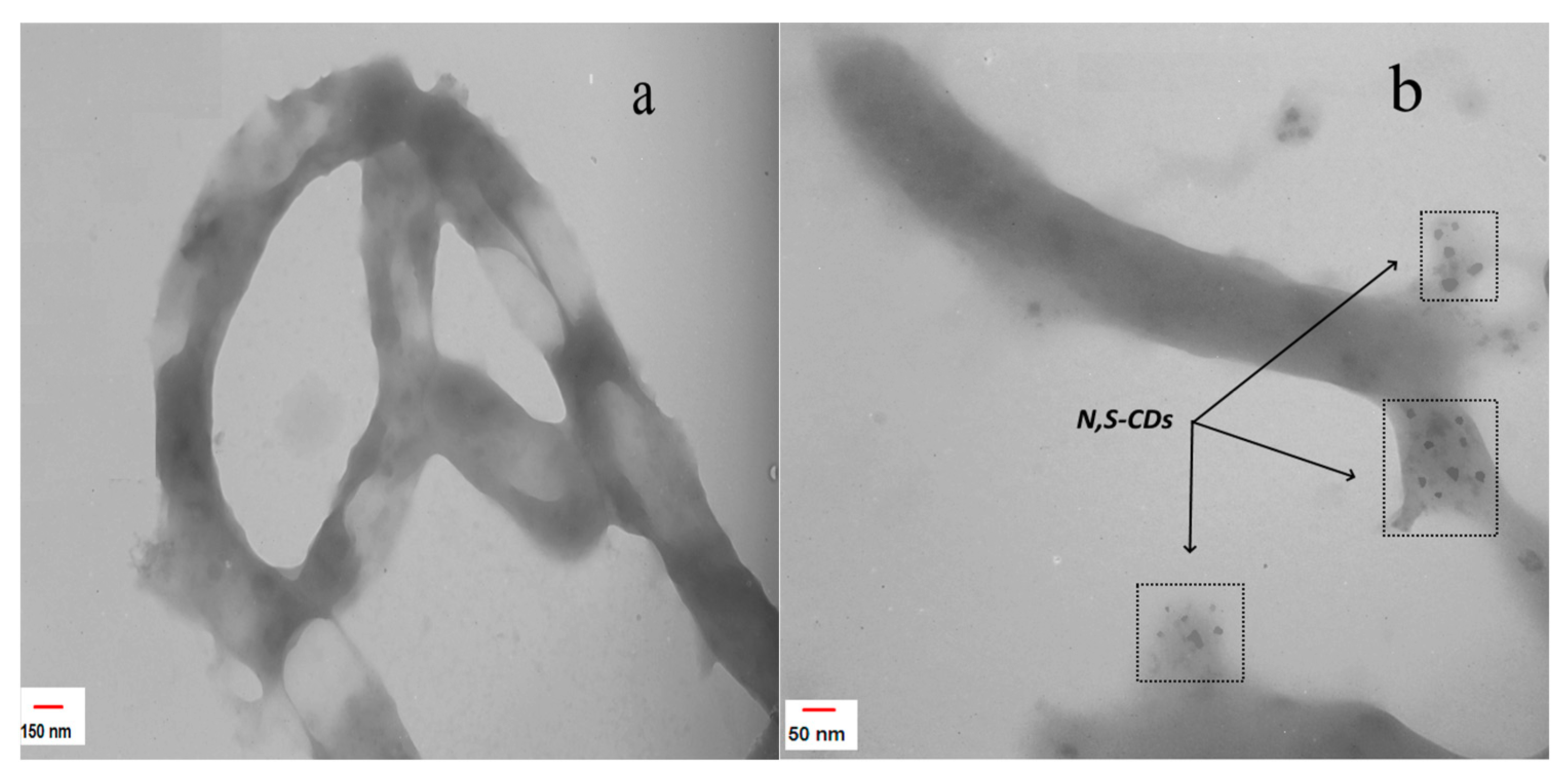 Biosensors 13 00547 g005
