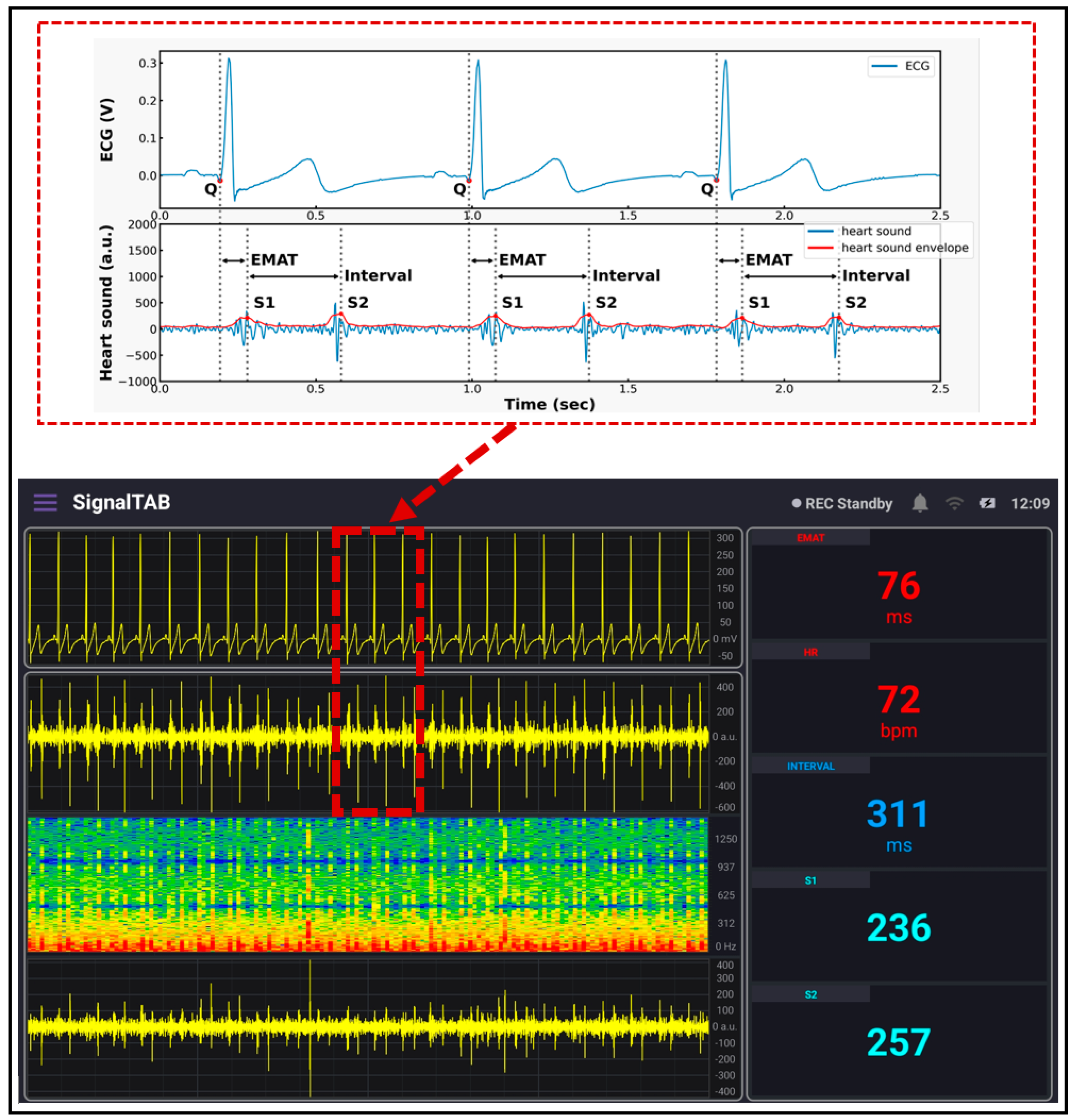 Biosensors 13 00615 g011