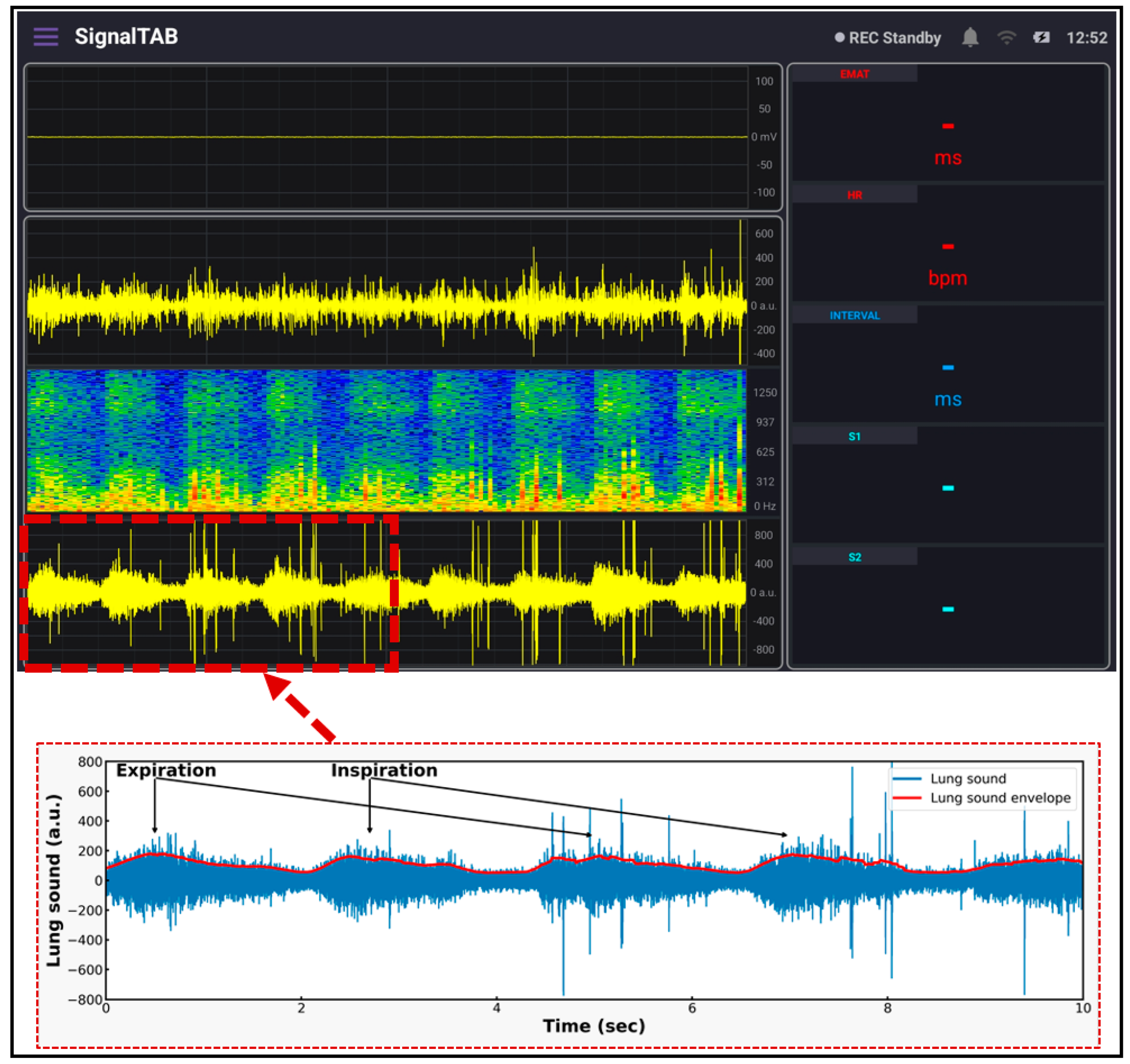 Biosensors 13 00615 g012